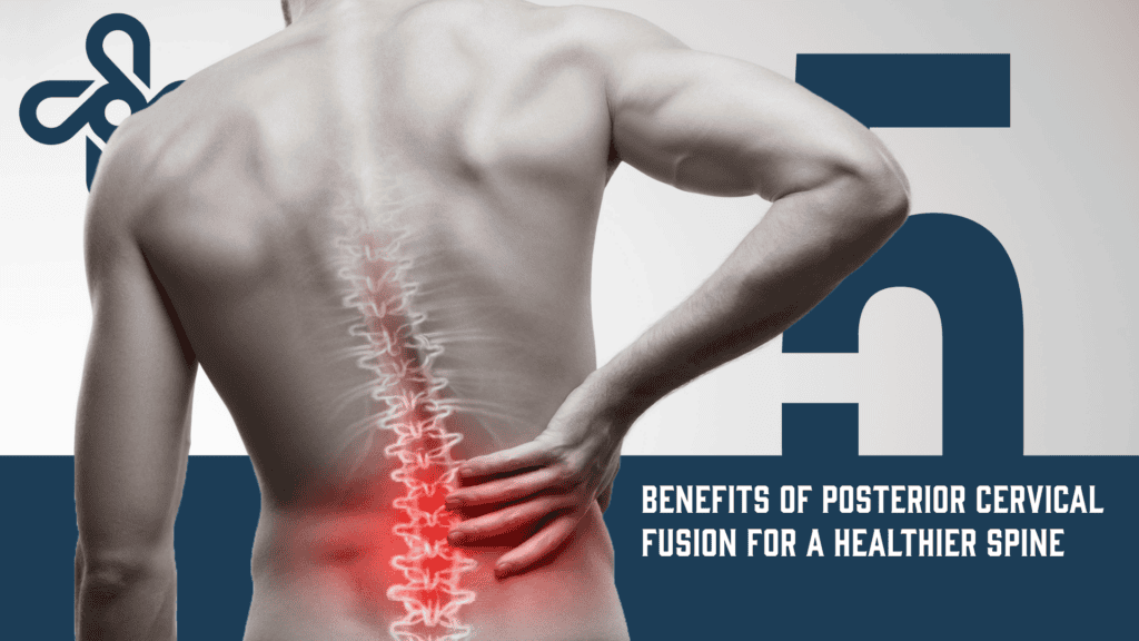 5 Benefits of Posterior Cervical Fusion for a Healthier Spine 7 Untitled 25